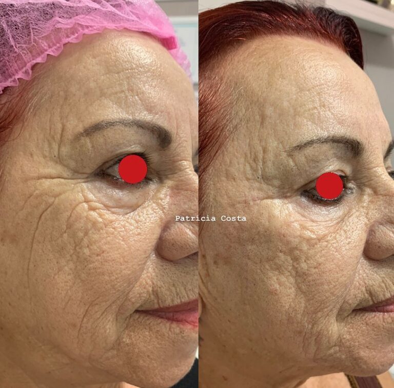 Revitalização Facial em Viamão – Dra. Patrícia Costa Biomédica