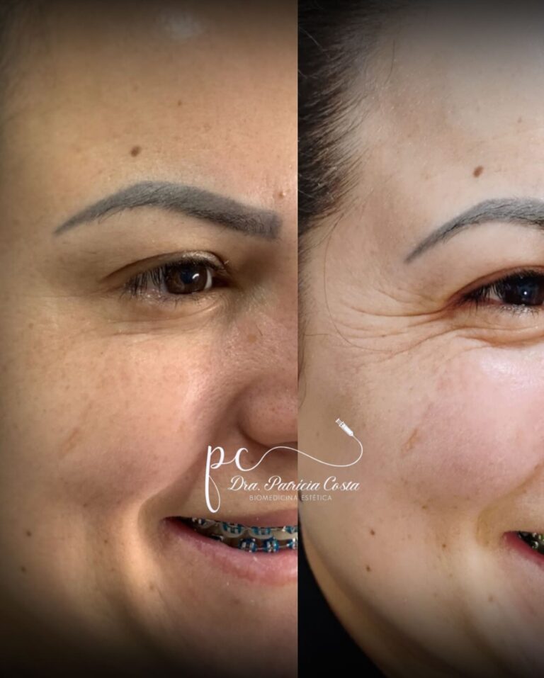 Revitalização Facial em Viamão – Dra. Patrícia Costa Biomédica