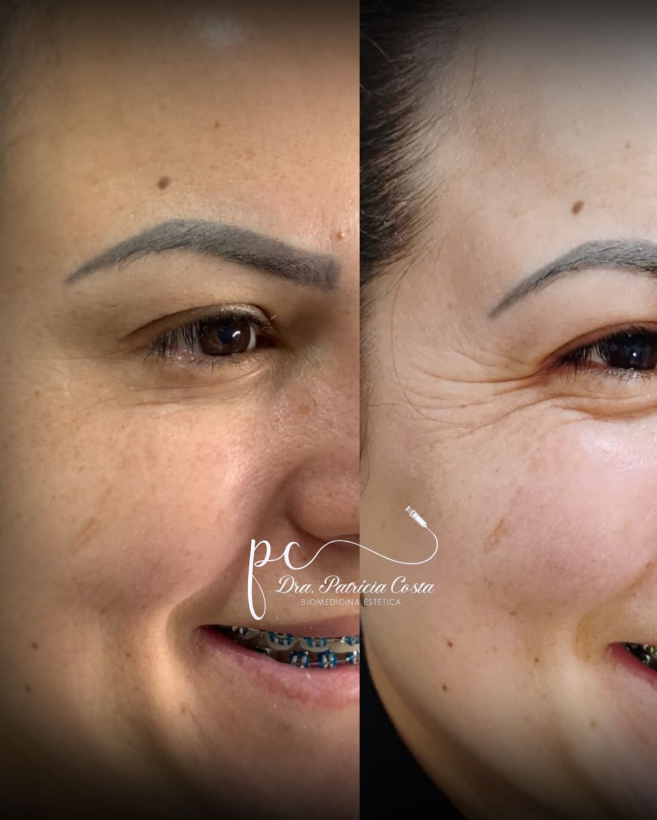 Revitalização Facial em Viamão – Dra. Patrícia Costa Biomédica Revitalização Facial em Viamão – Dra. Patrícia Costa Biomédica